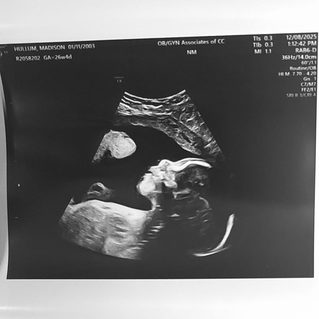 Photo shared by Madison for their Babylist baby registry.