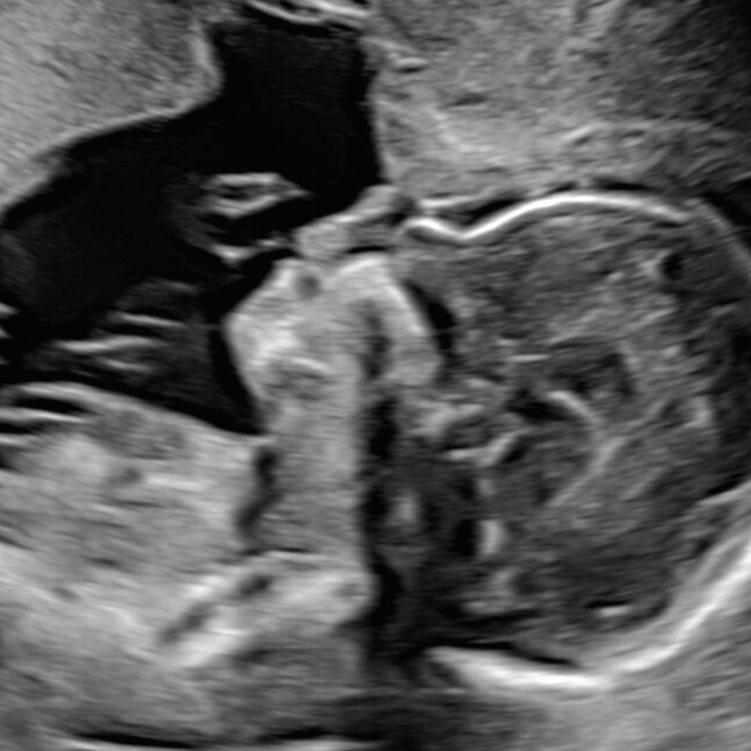 Photo shared by Chrissy for their Babylist baby registry.