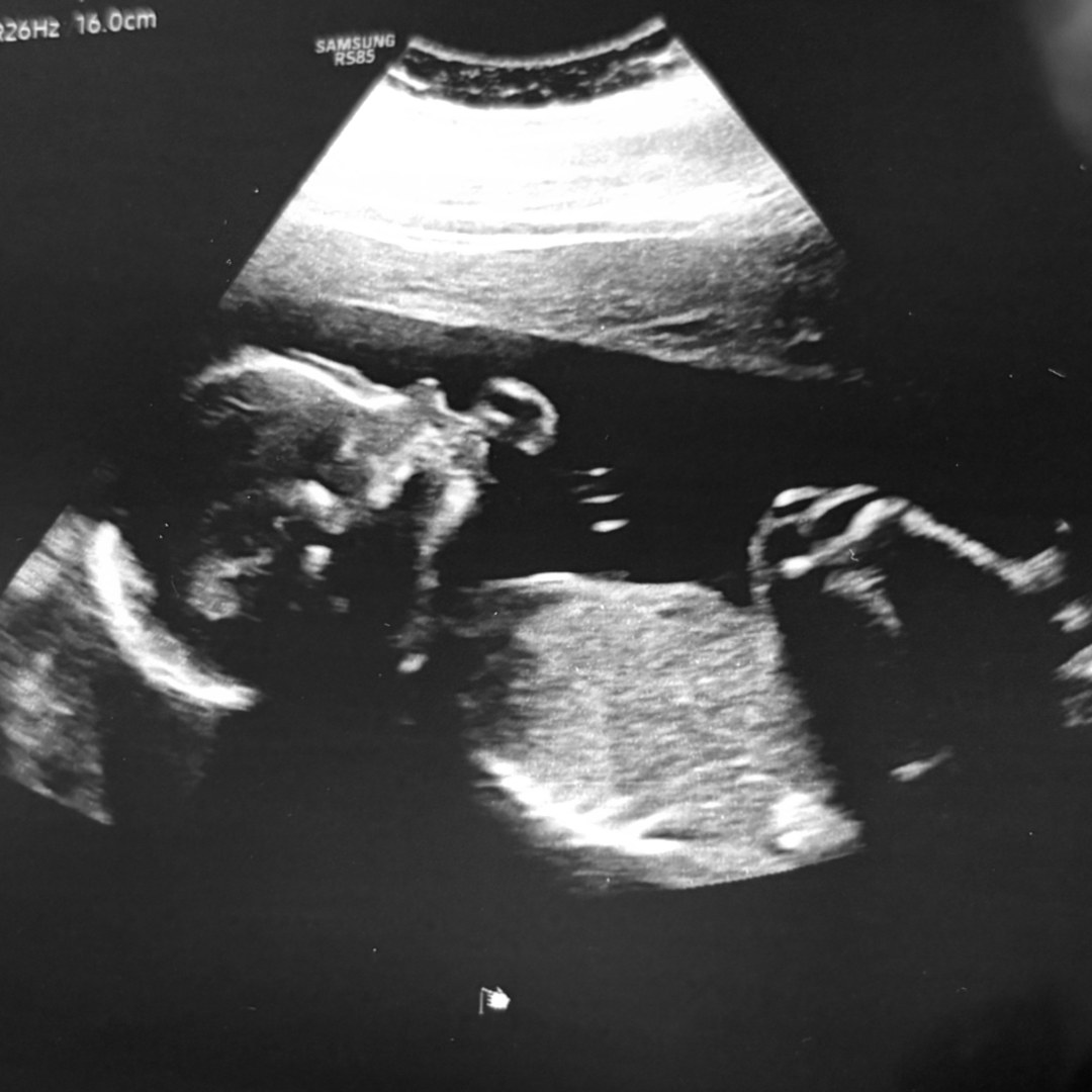 Photo shared by Alex for their Babylist baby registry.