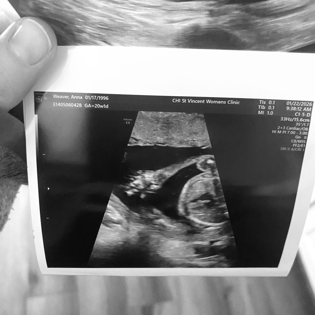 Photo shared by Annie for their Babylist baby registry.