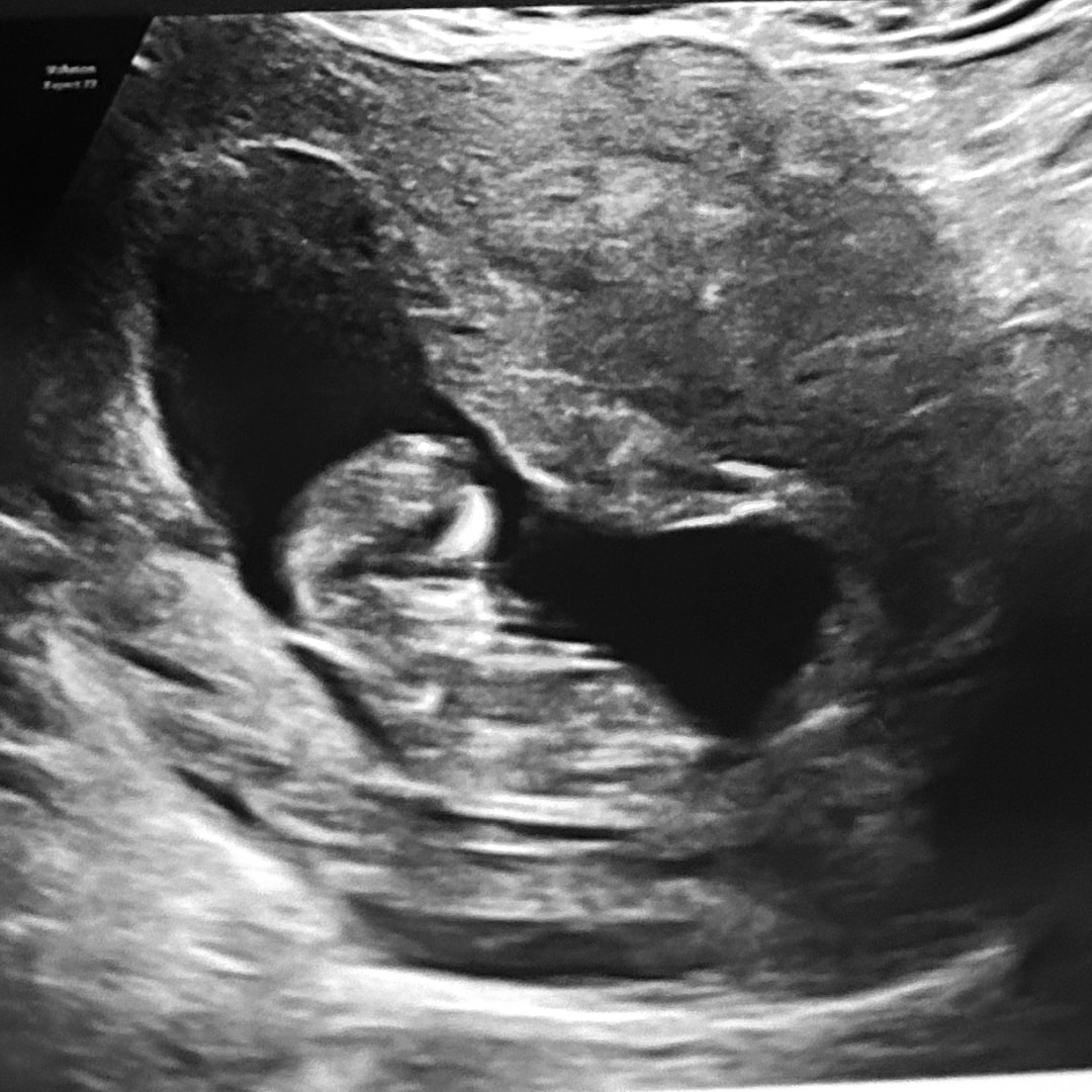 Photo shared by Ella for their Babylist baby registry.