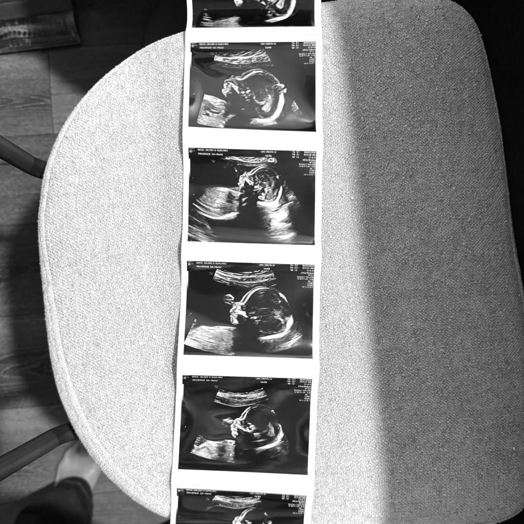 Photo shared by Valerie for their Babylist baby registry.