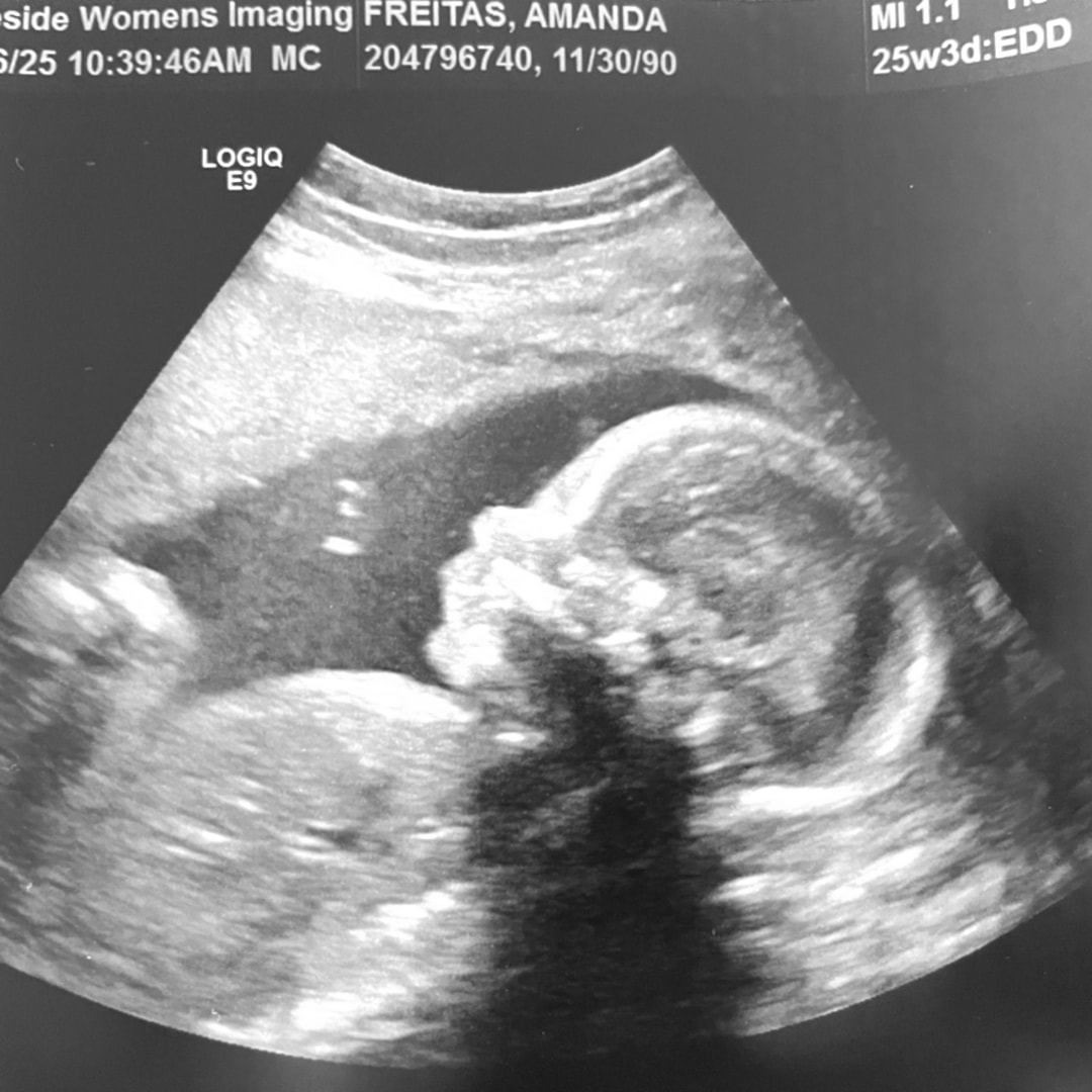 Photo shared by Amanda for their Babylist baby registry.