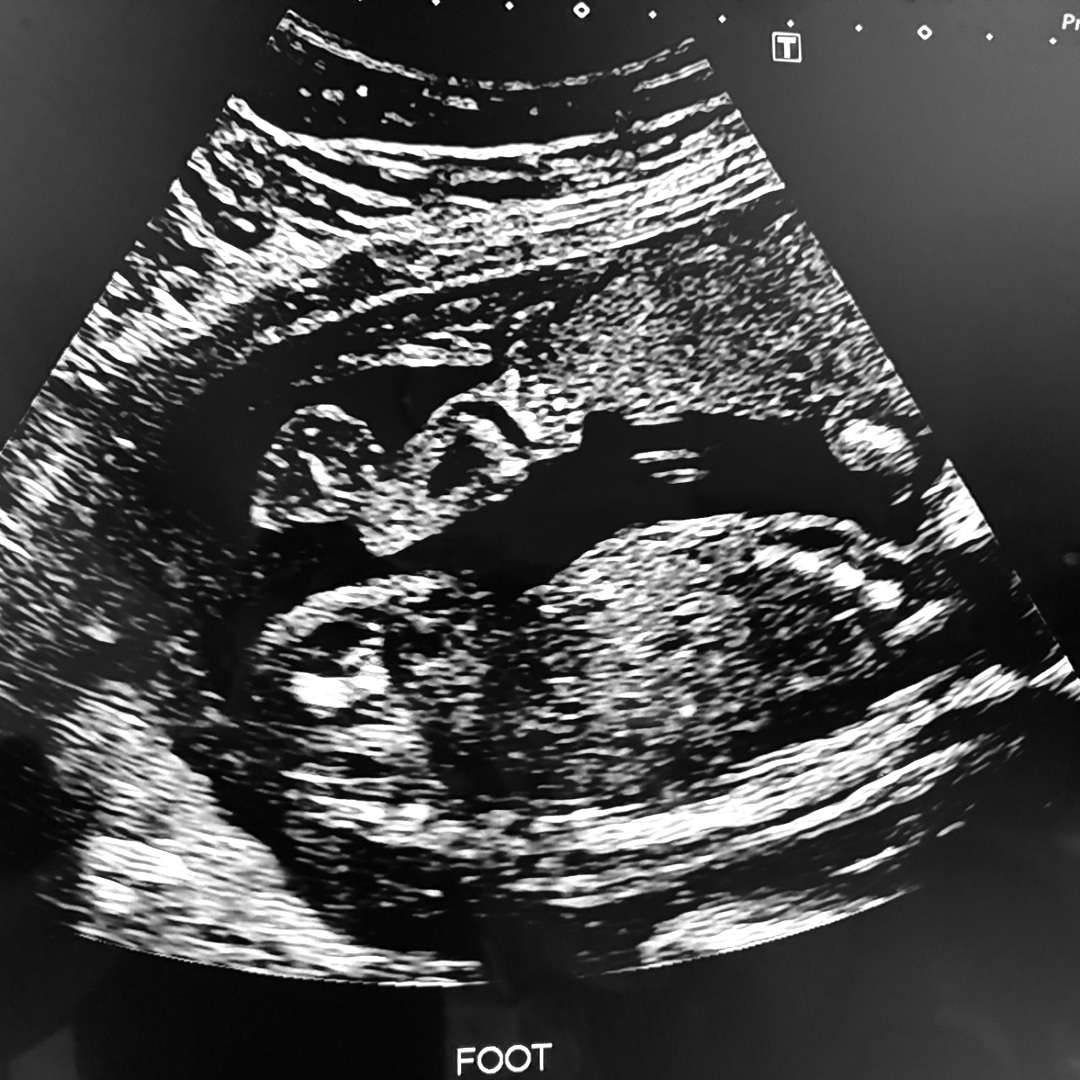Photo shared by Francesca for their Babylist baby registry.