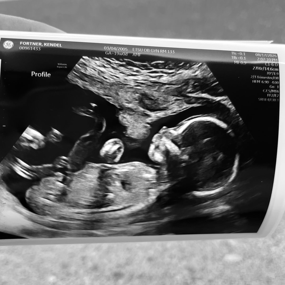 Photo shared by Kendel for their Babylist baby registry.