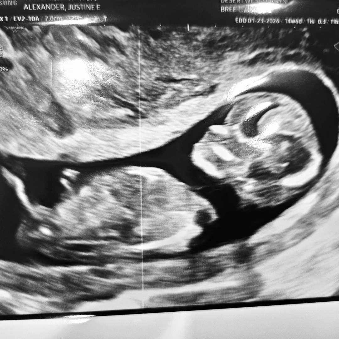 Photo shared by Justine for their Babylist baby registry.