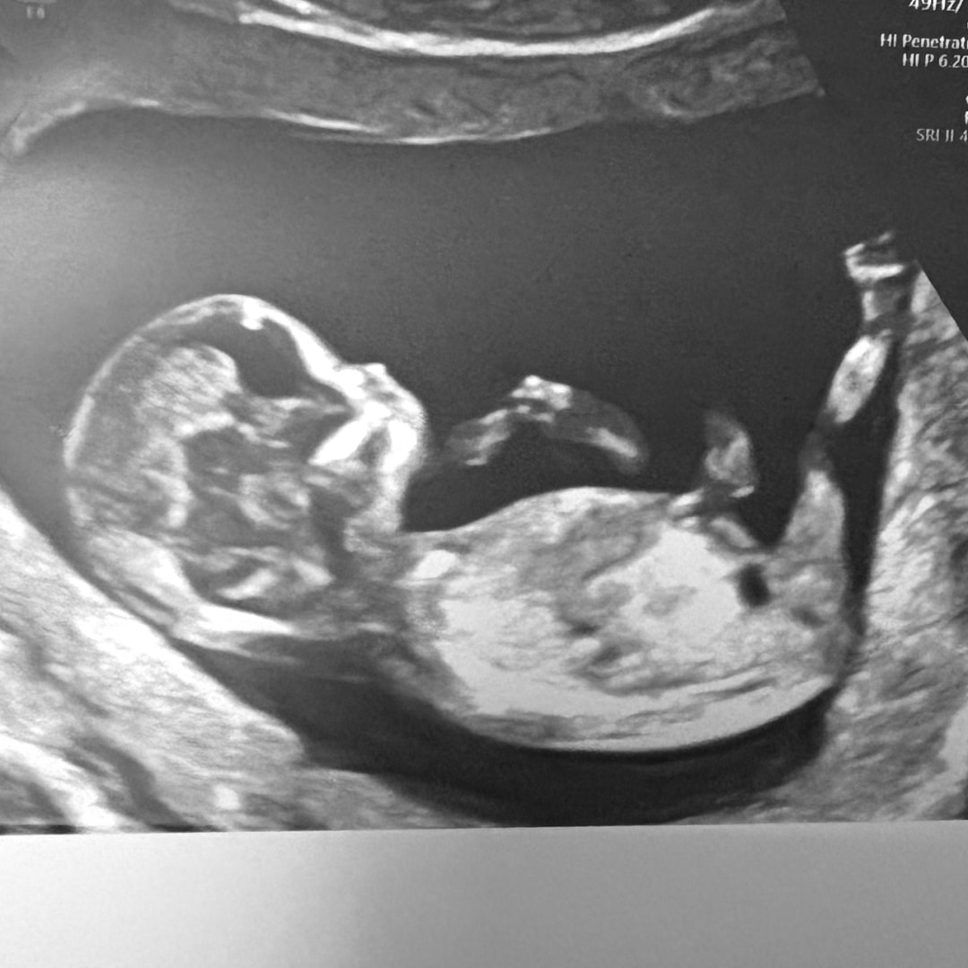 Photo shared by Samantha for their Babylist baby registry.