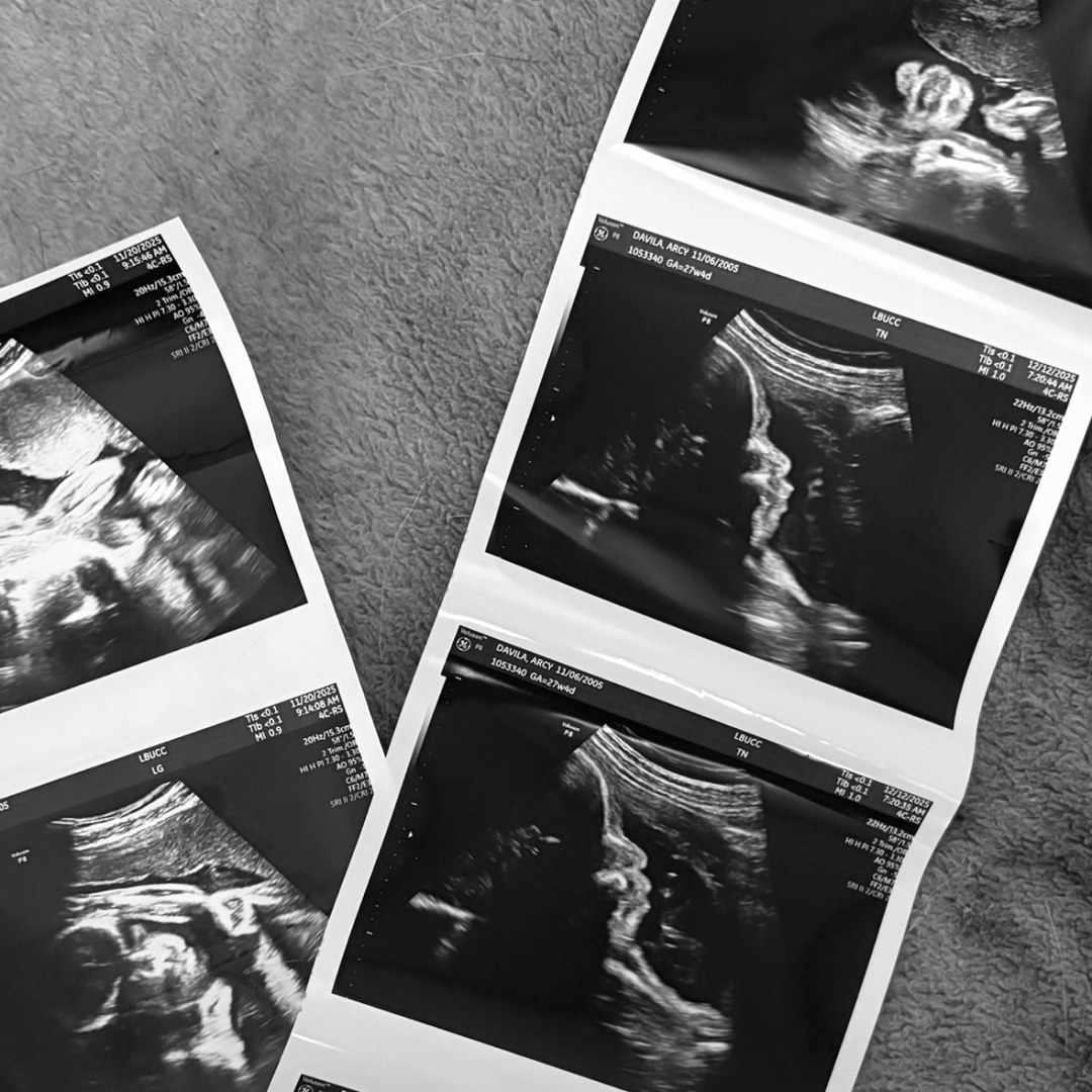 Photo shared by Arcy for their Babylist baby registry.