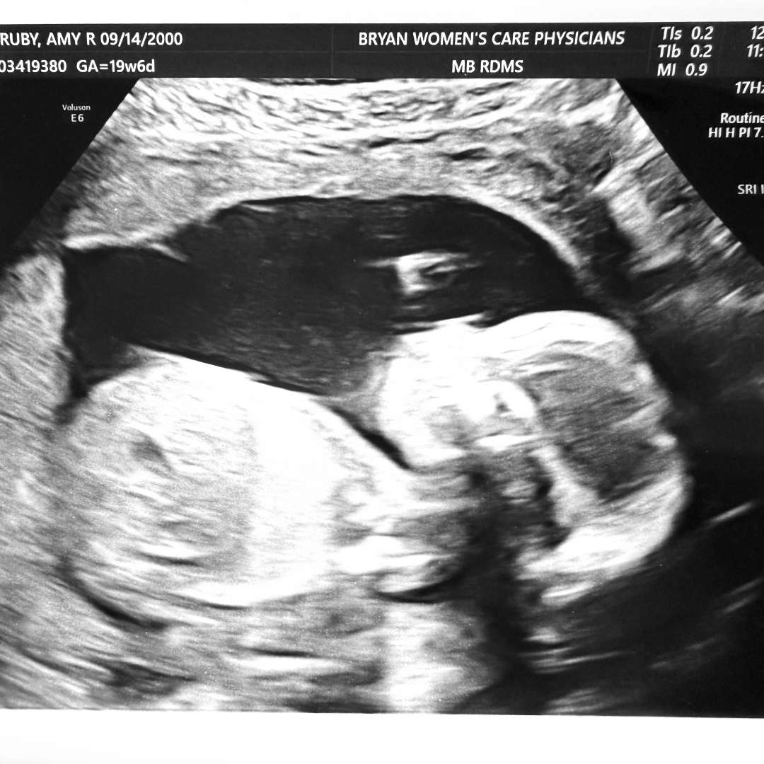 Photo shared by Amy for their Babylist baby registry.