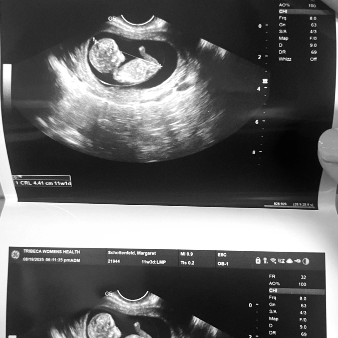 Photo shared by Maggie for their Babylist baby registry.