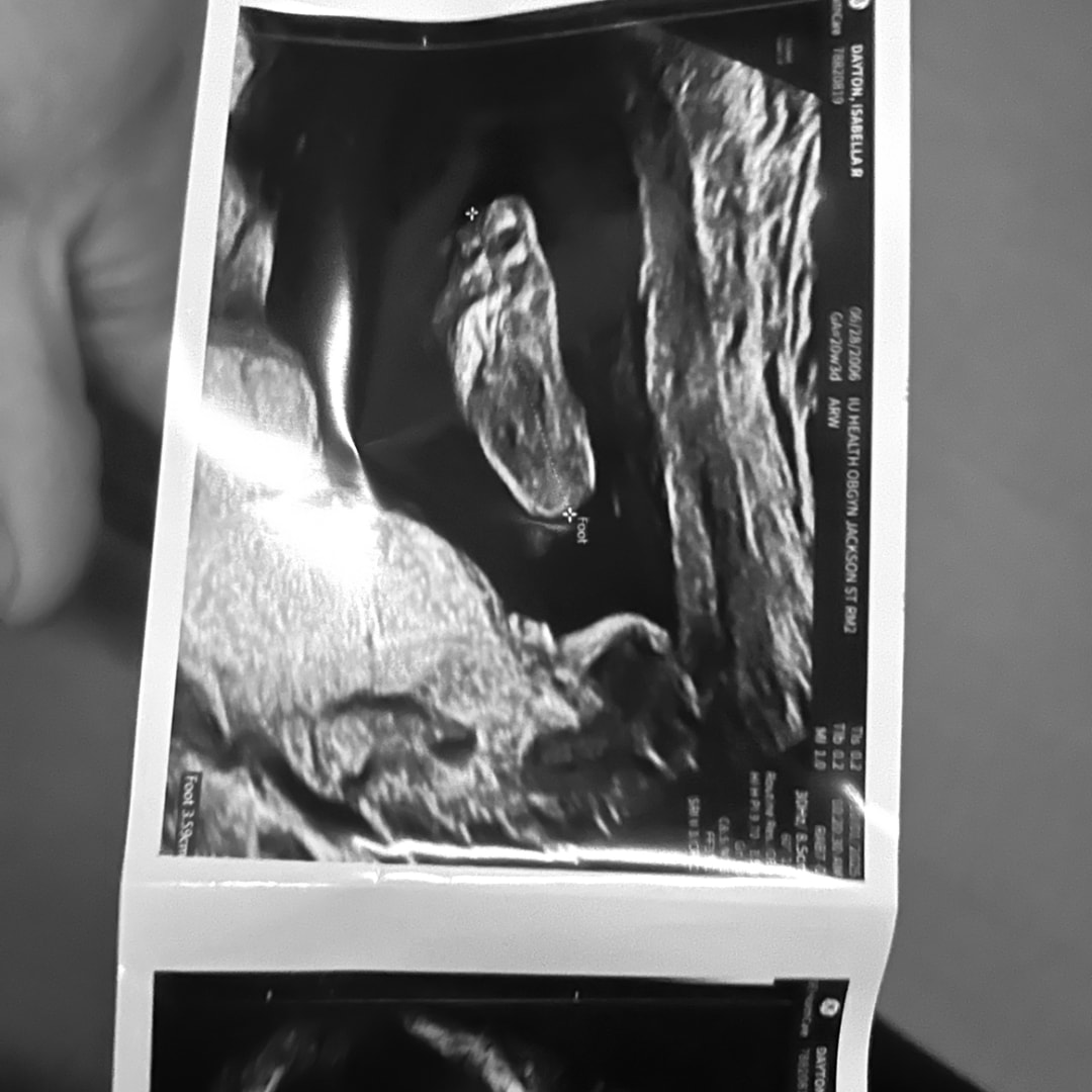 Photo shared by Isabella for their Babylist baby registry.