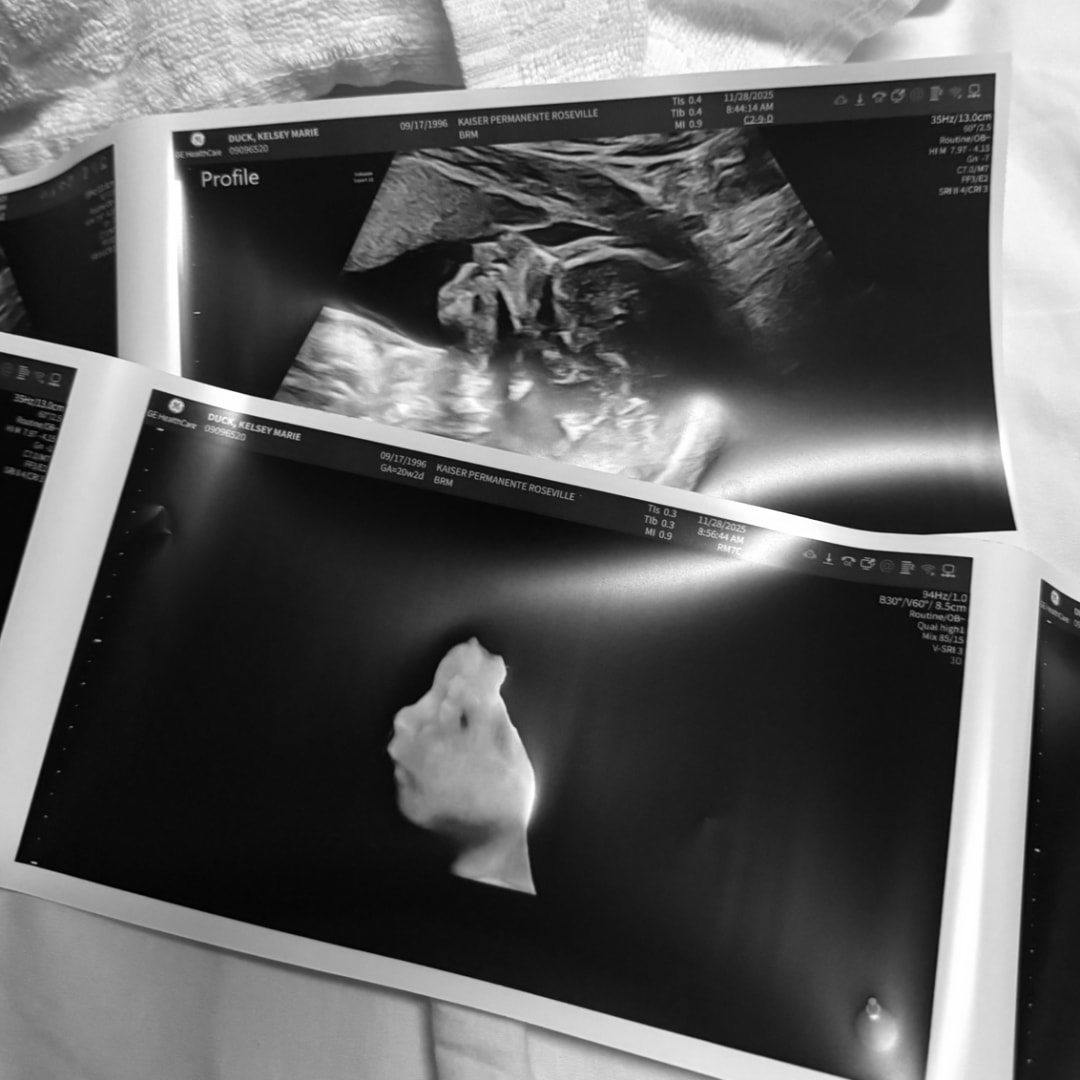 Photo shared by Kelsey for their Babylist baby registry.