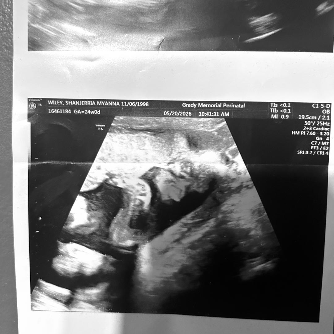 Photo shared by ShanJerria for their Babylist baby registry.