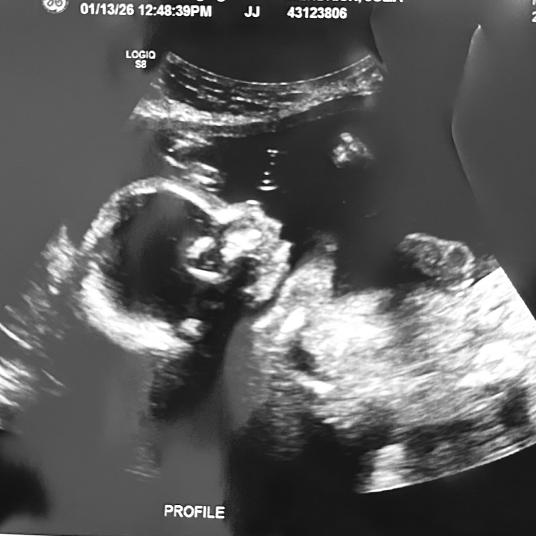 Photo shared by Julia for their Babylist baby registry.