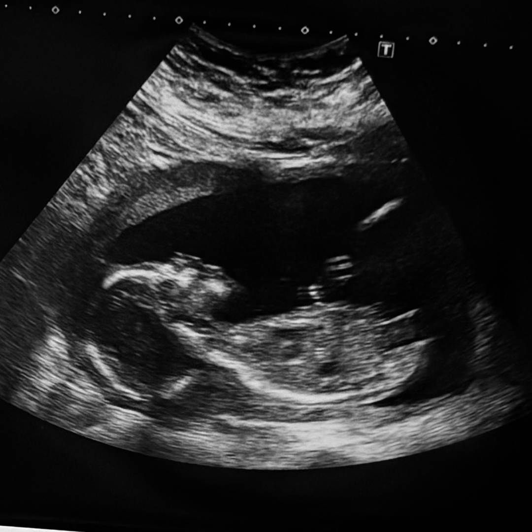 Photo shared by Mia for their Babylist baby registry.