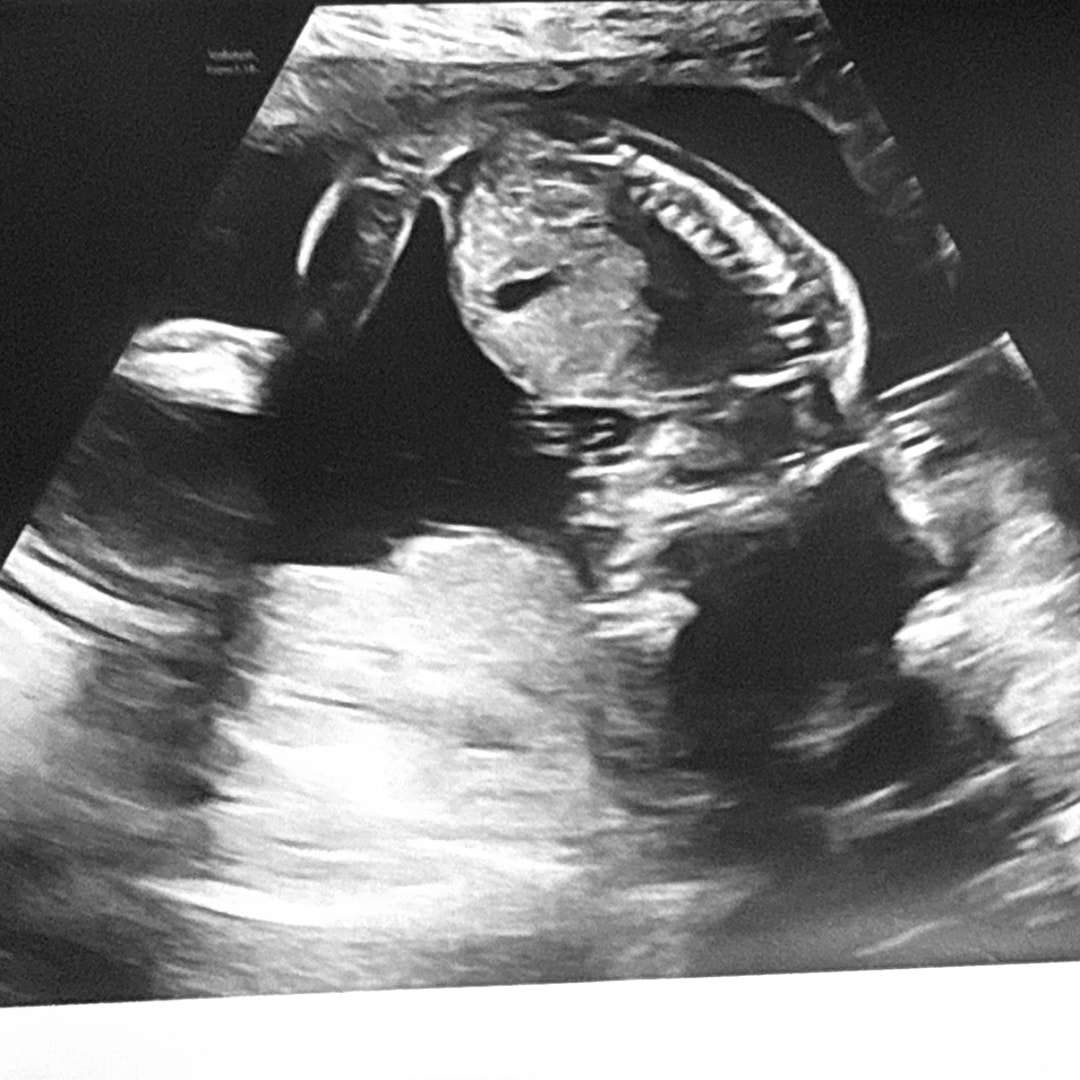 Photo shared by Caitlyn for their Babylist baby registry.