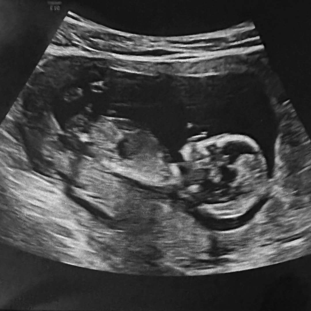Photo shared by Hayleigh-Marie for their Babylist baby registry.