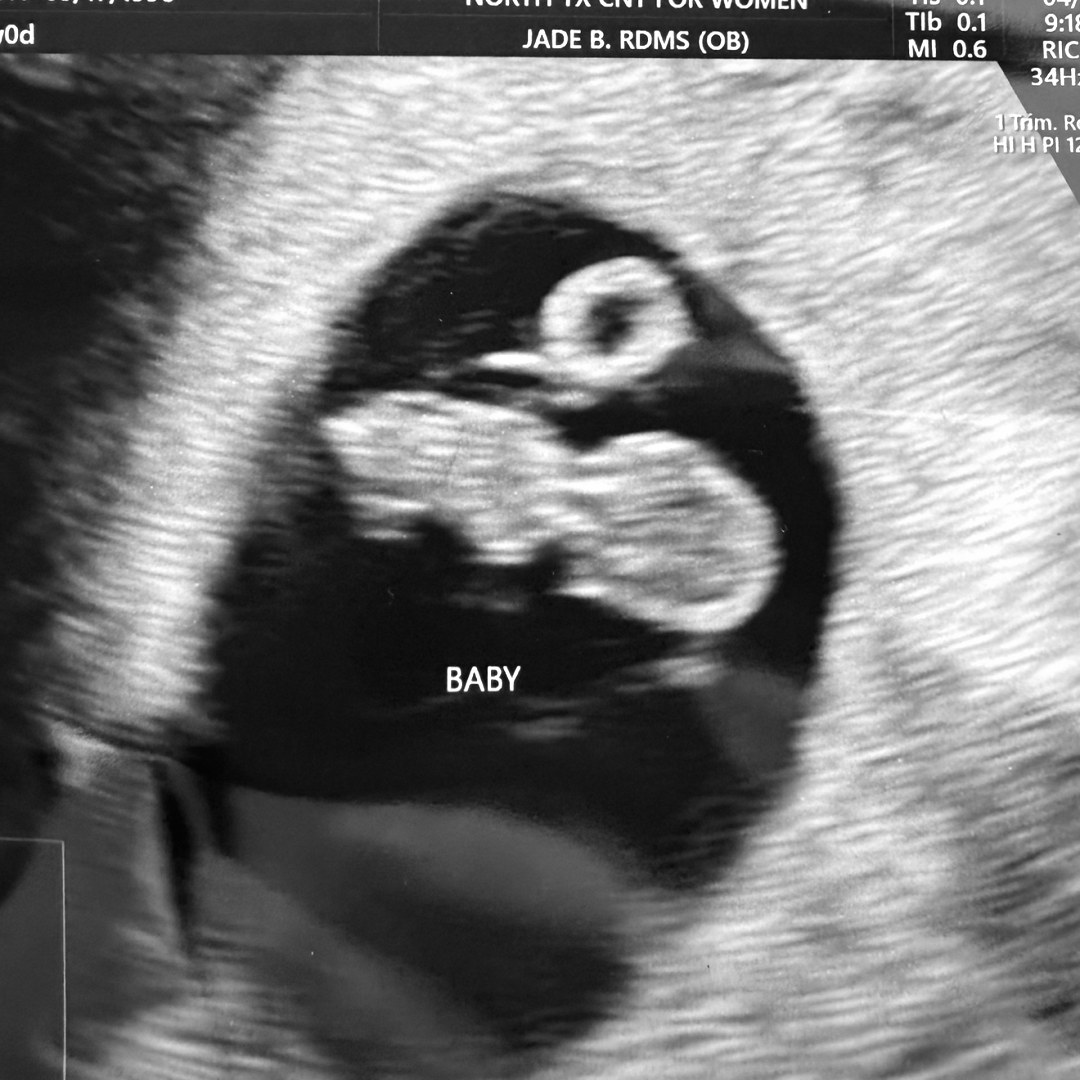 Photo shared by Chalyn for their Babylist baby registry.