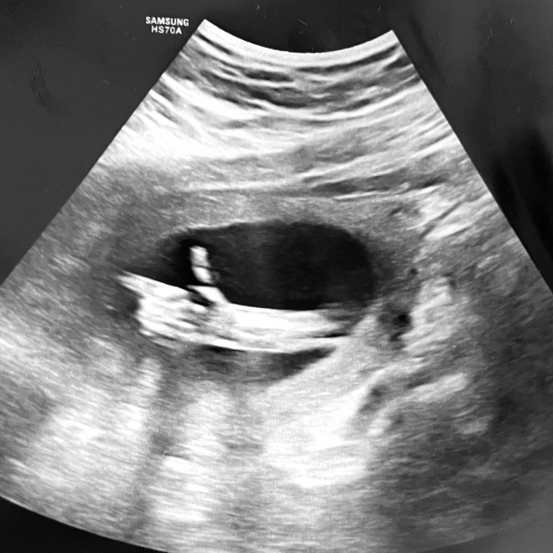 Photo shared by Madison for their Babylist baby registry.
