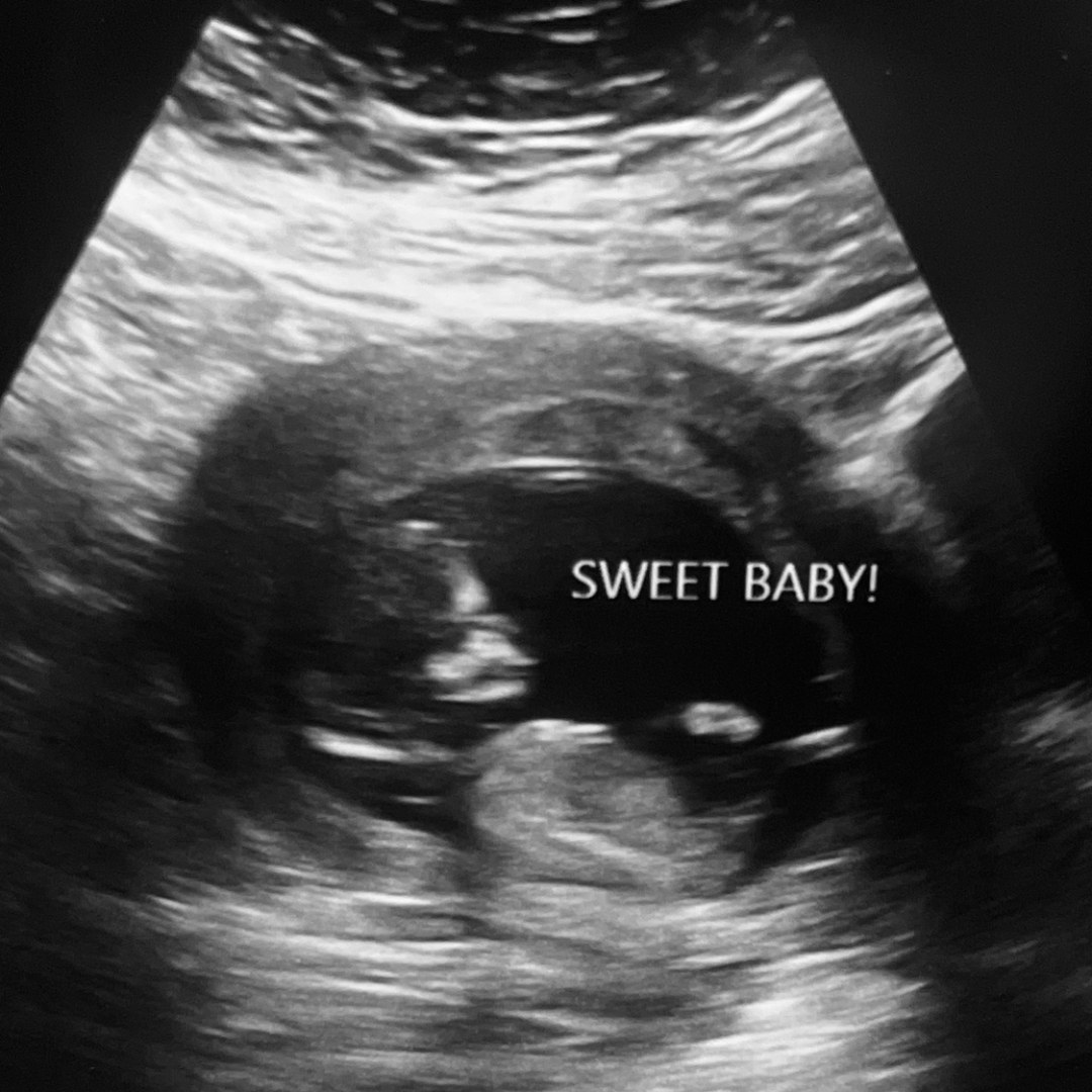 Photo shared by Ariel for their Babylist baby registry.