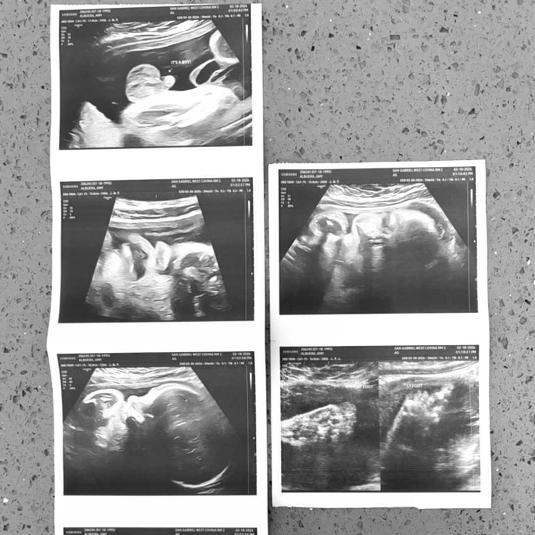 Photo shared by Amy for their Babylist baby registry.