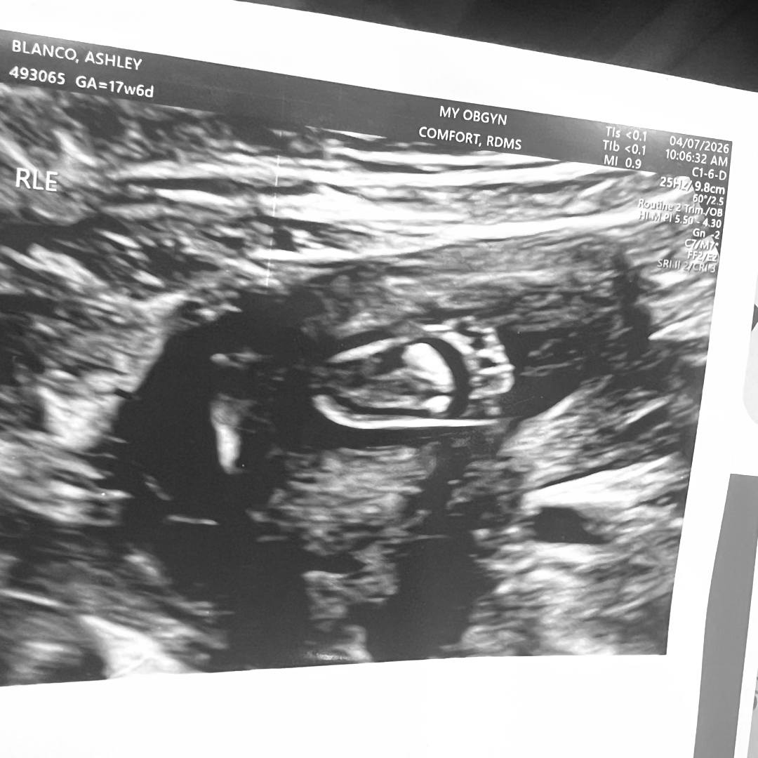 Photo shared by Connie for their Babylist baby registry.