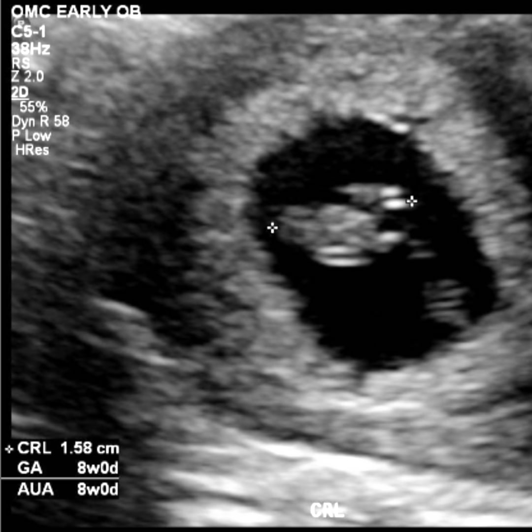 Photo shared by Julia for their Babylist baby registry.