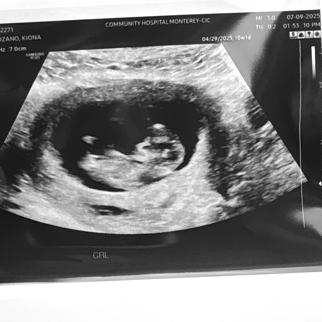 Photo shared by Kiona for their Babylist baby registry.