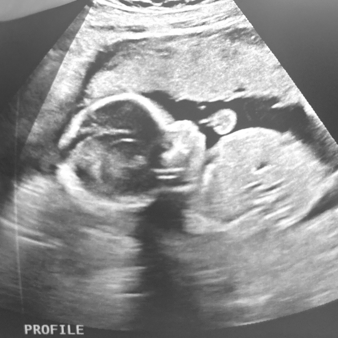 Photo shared by Briana & Jimmy for their Babylist baby registry.
