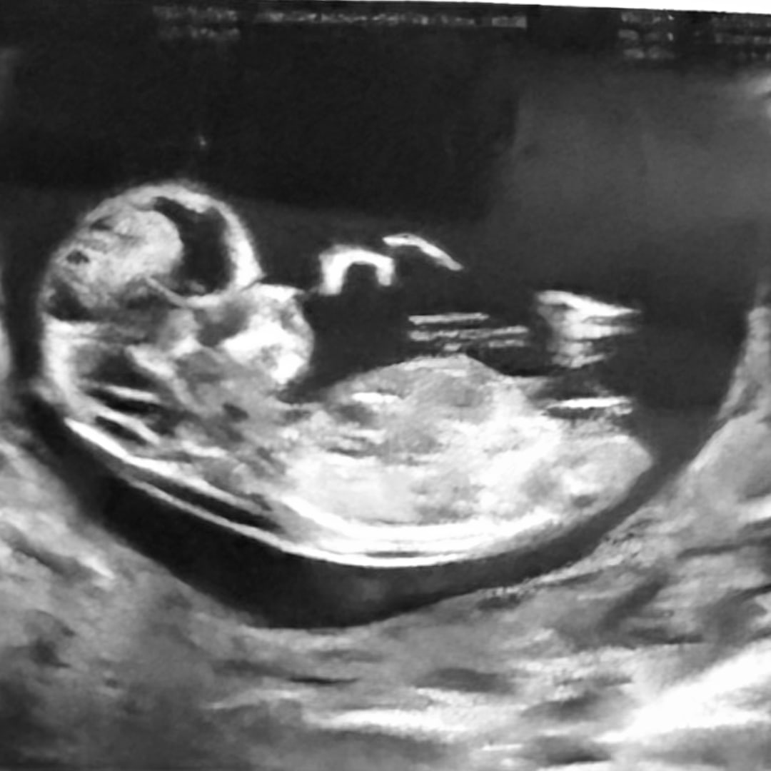 Photo shared by Nia for their Babylist baby registry.