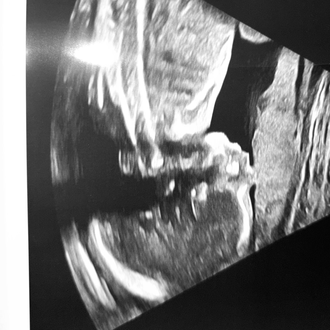 Photo shared by Kiara for their Babylist baby registry.