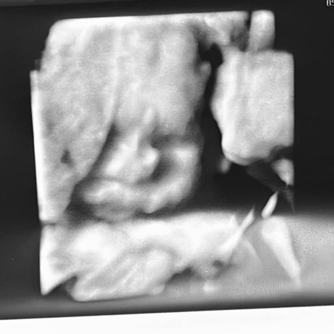 Photo shared by Carlianne for their Babylist baby registry.