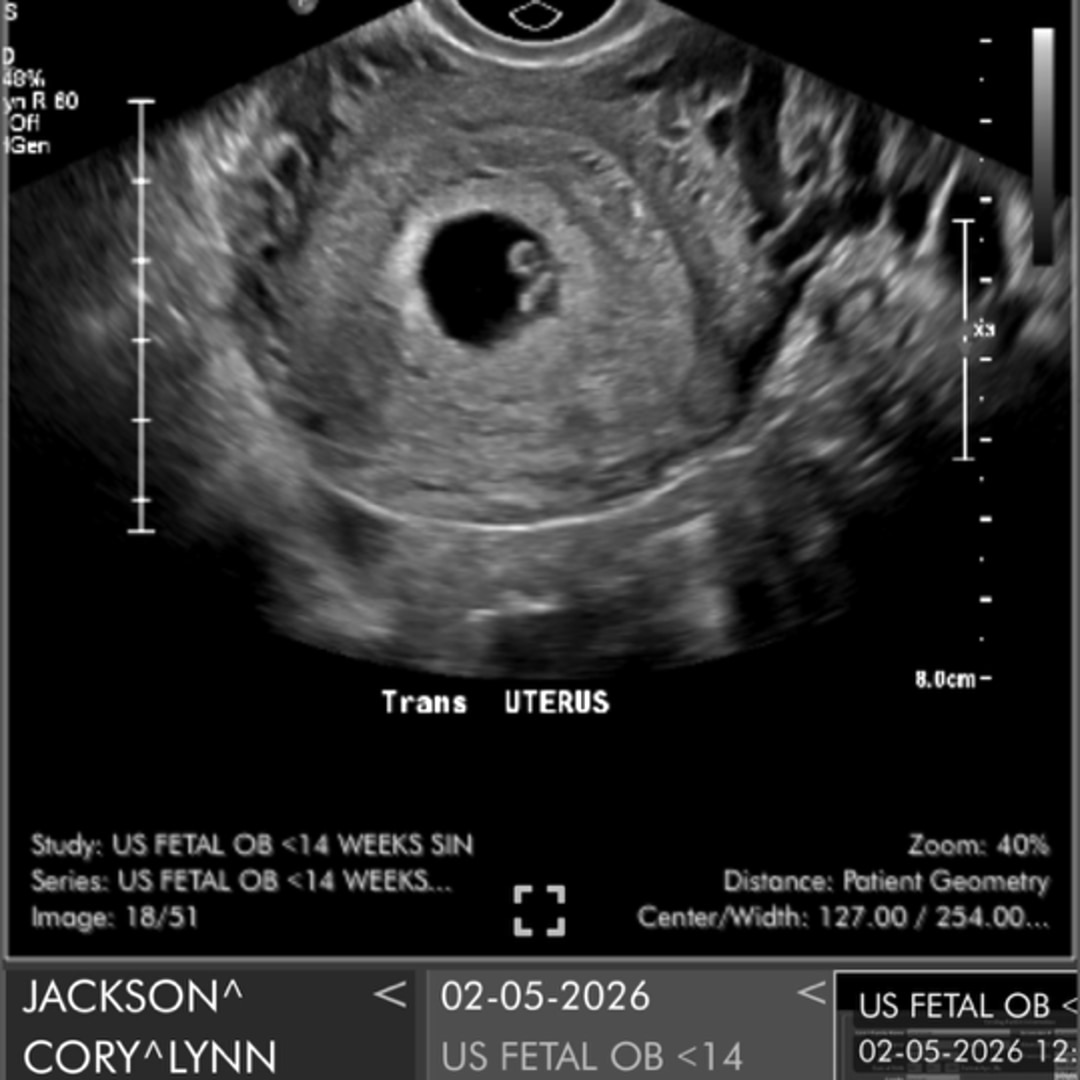 Photo shared by Cory Lynn for their Babylist baby registry.