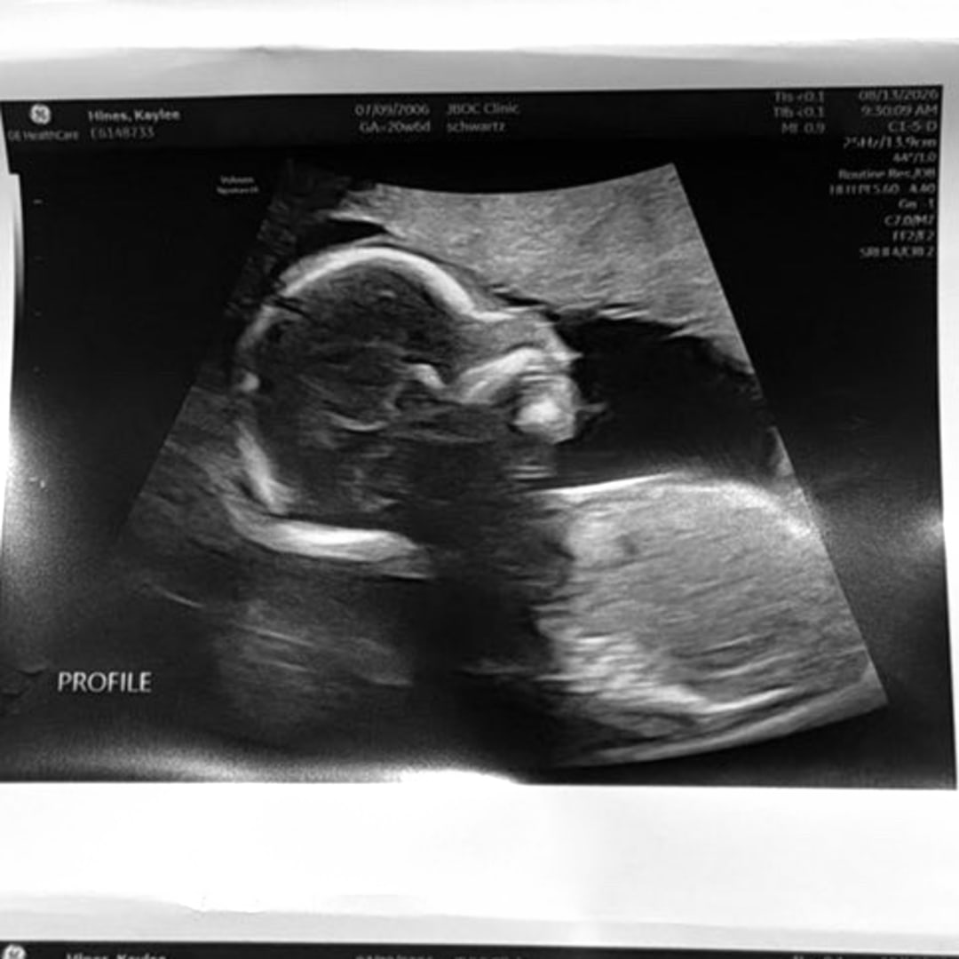 Photo shared by Kaylee for their Babylist baby registry.