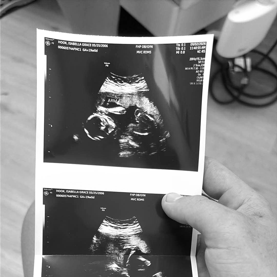 Photo shared by Isabella for their Babylist baby registry.