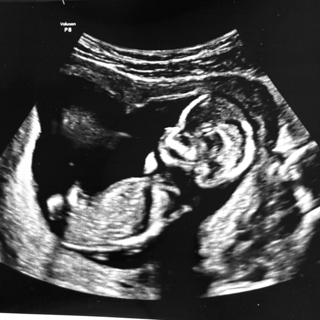 Photo shared by Isabelle for their Babylist baby registry.