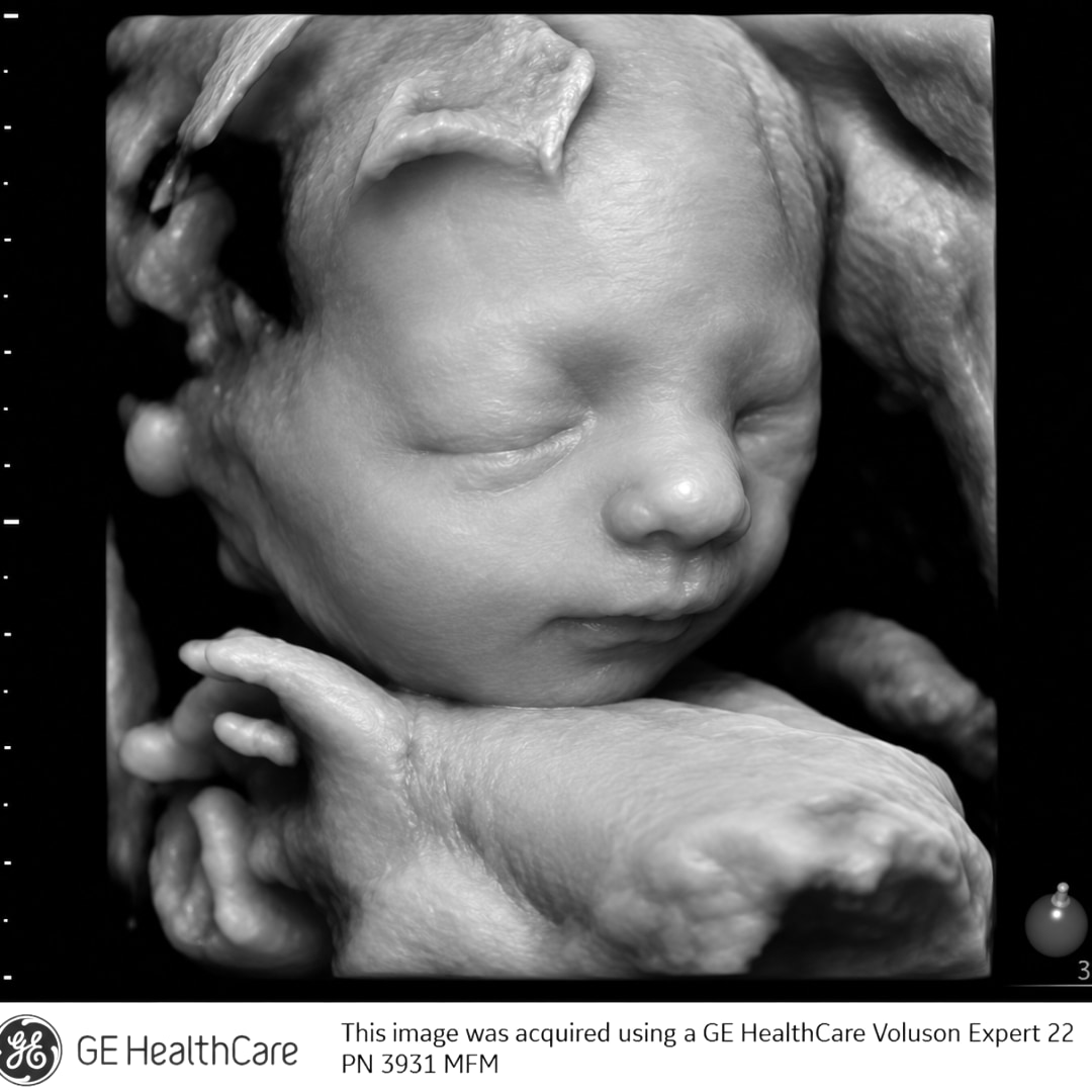 Photo shared by Brittni for their Babylist baby registry.