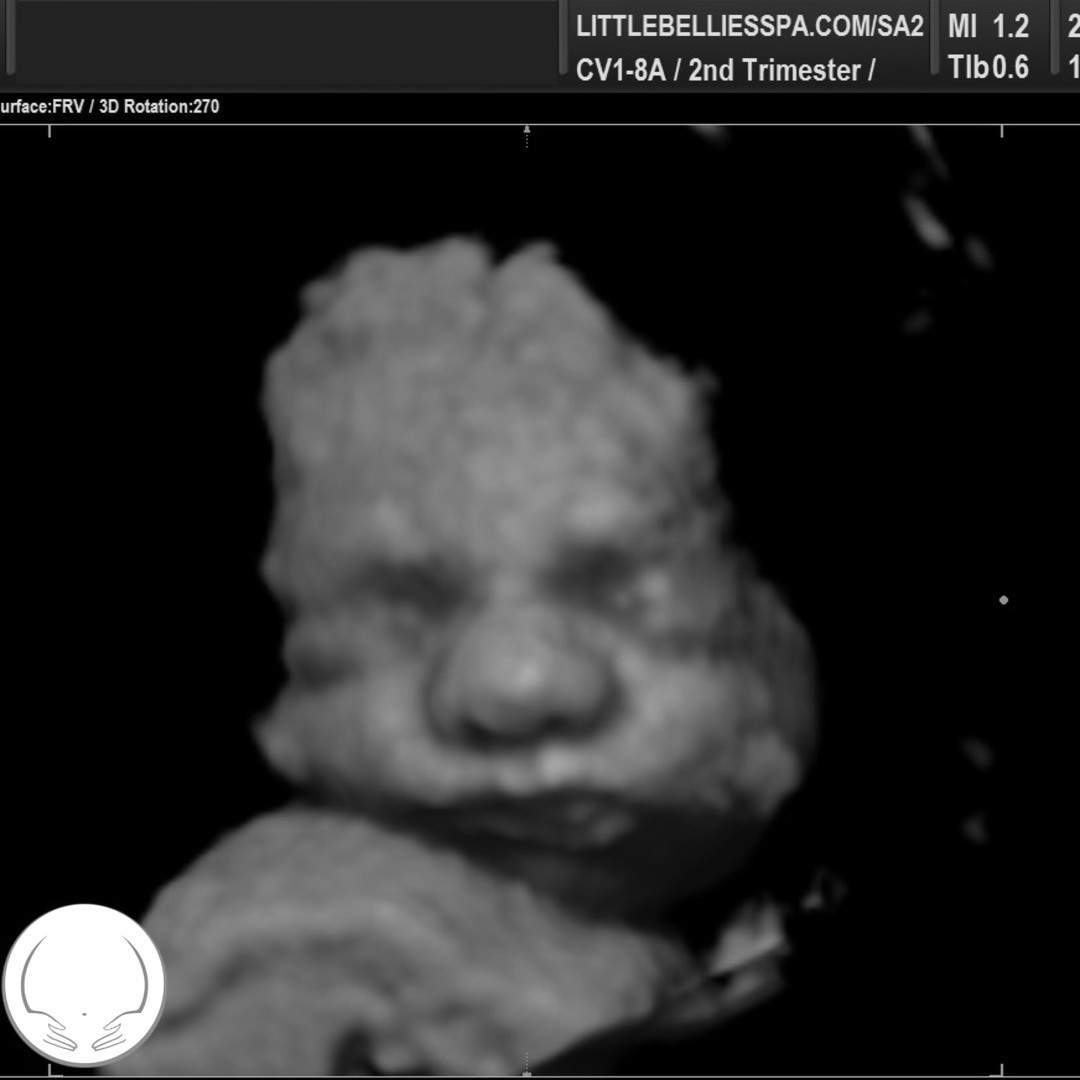 Photo shared by Alexis for their Babylist baby registry.