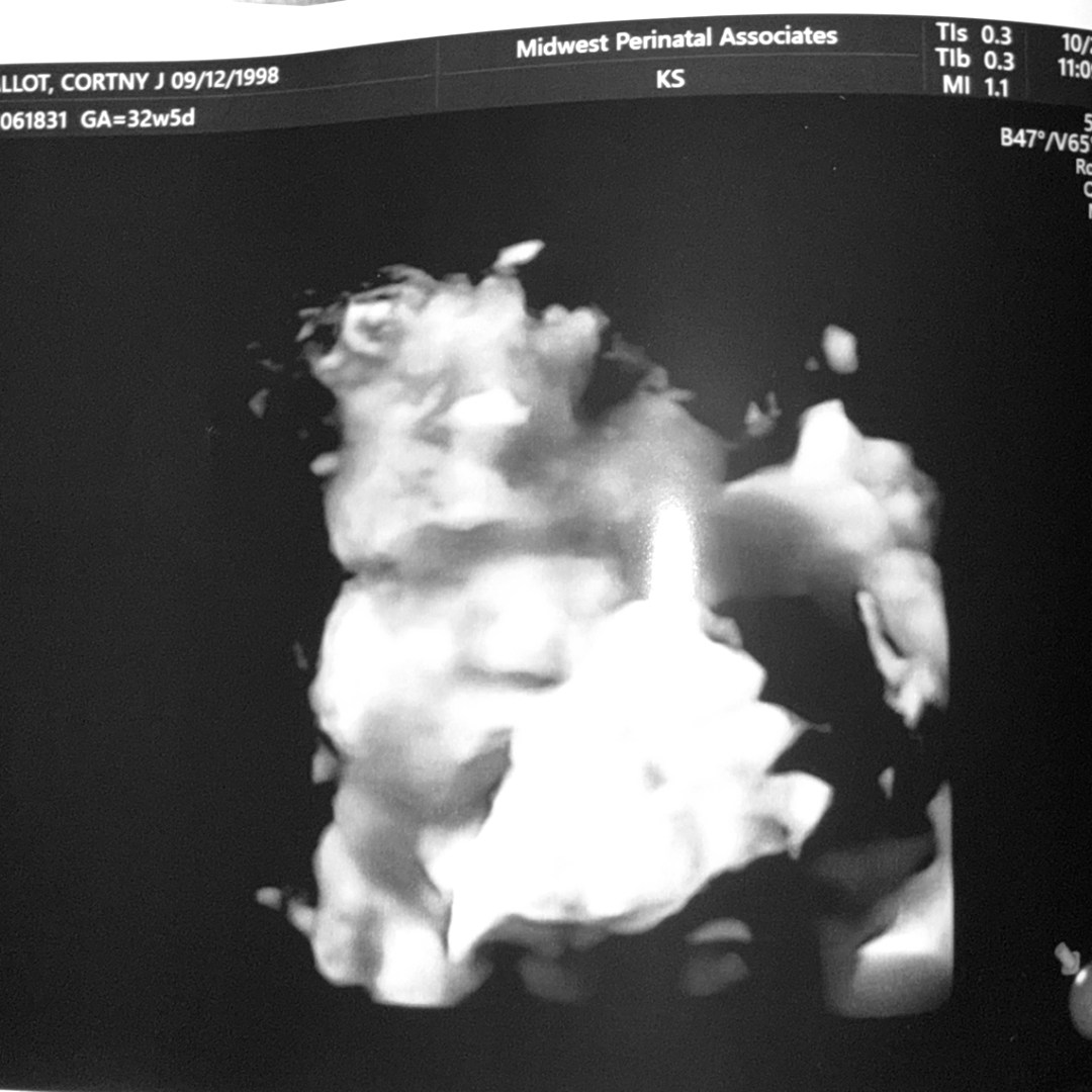 Photo shared by Cortny for their Babylist baby registry.