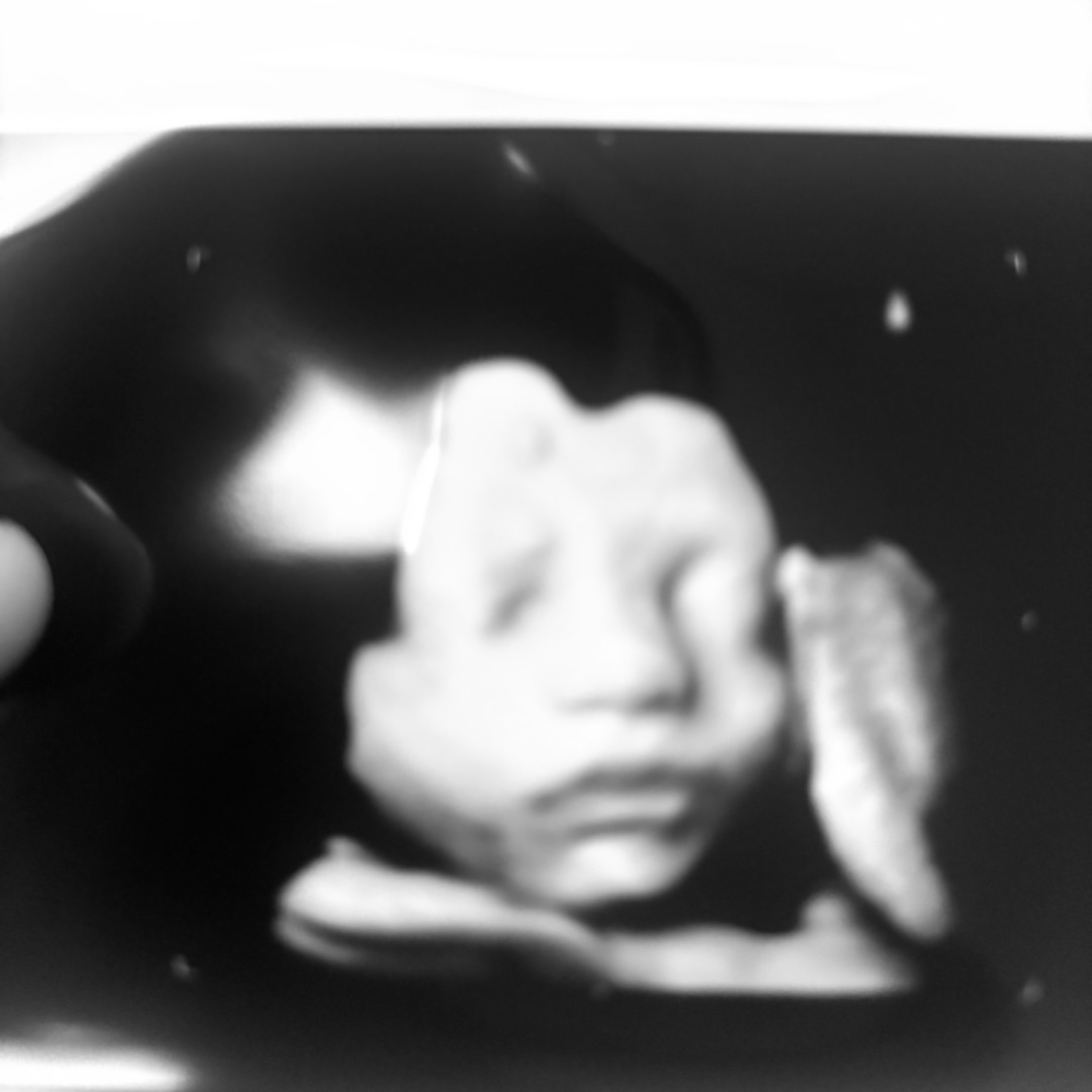 Photo shared by Madison for their Babylist baby registry.