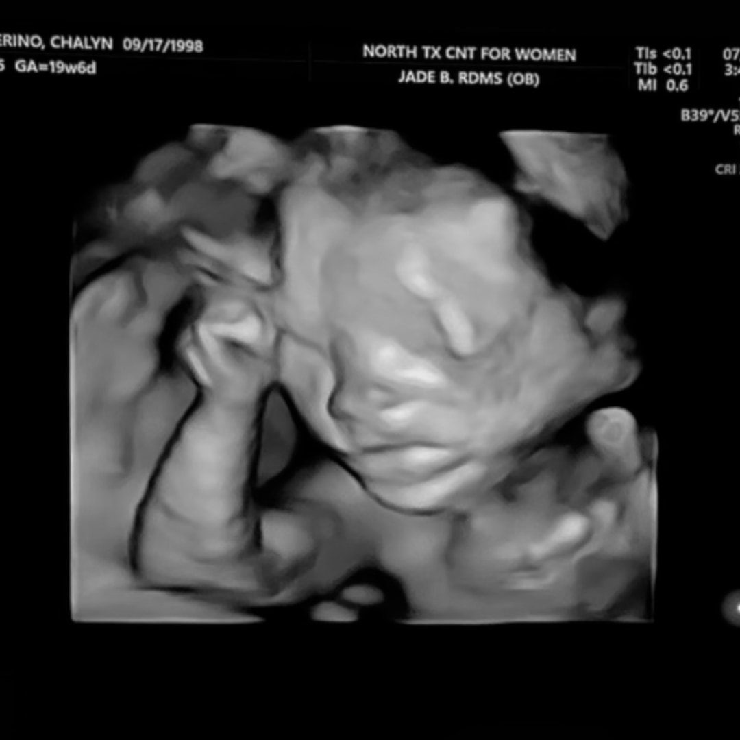 Photo shared by Chalyn for their Babylist baby registry.
