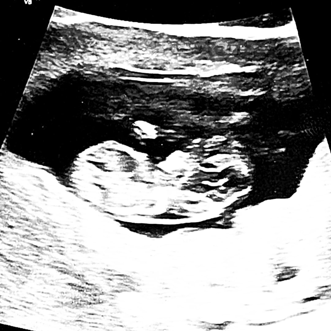 Photo shared by Catherine for their Babylist baby registry.