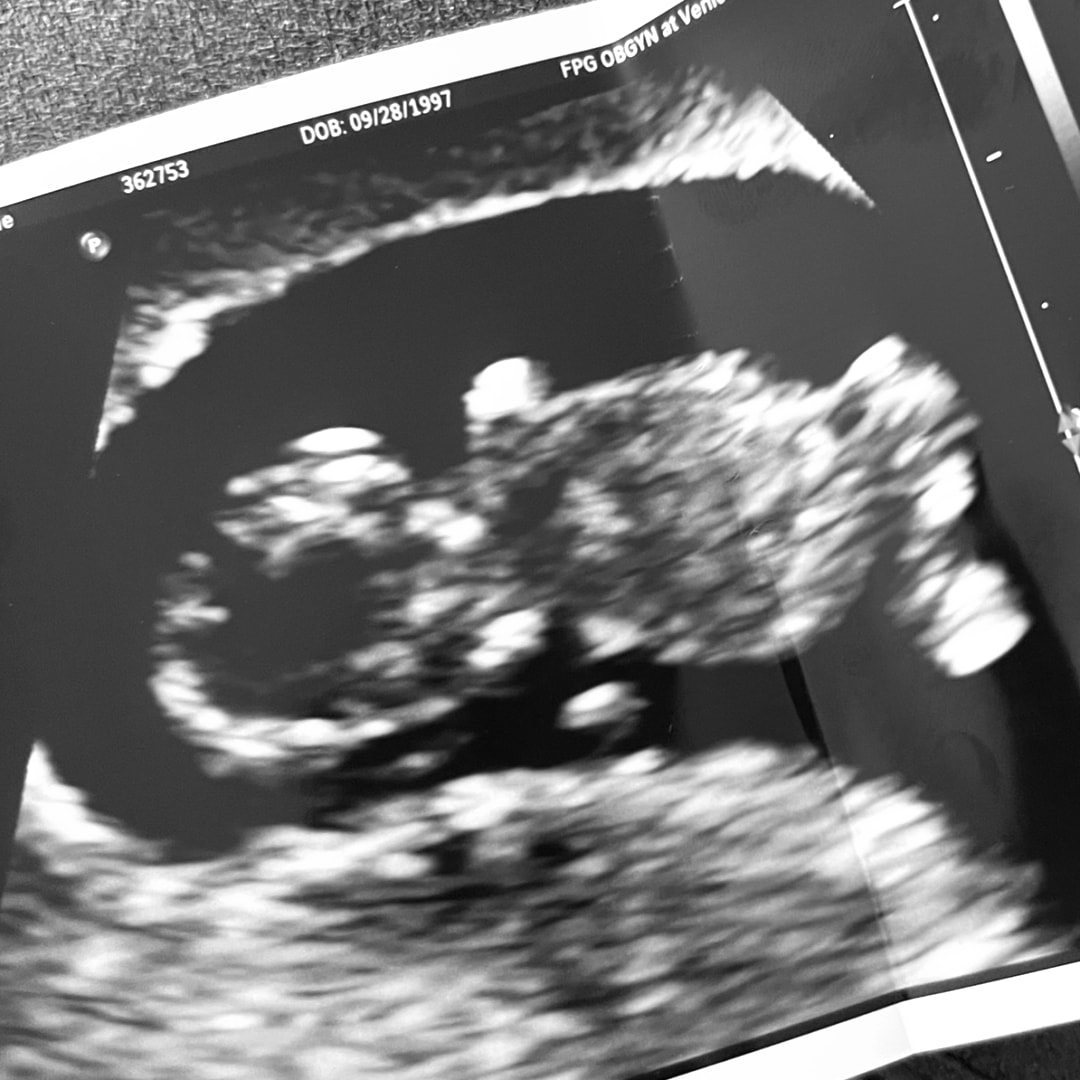 Photo shared by Cayti for their Babylist baby registry.