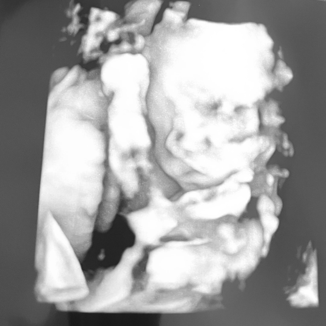 Photo shared by Nayaltzin for their Babylist baby registry.
