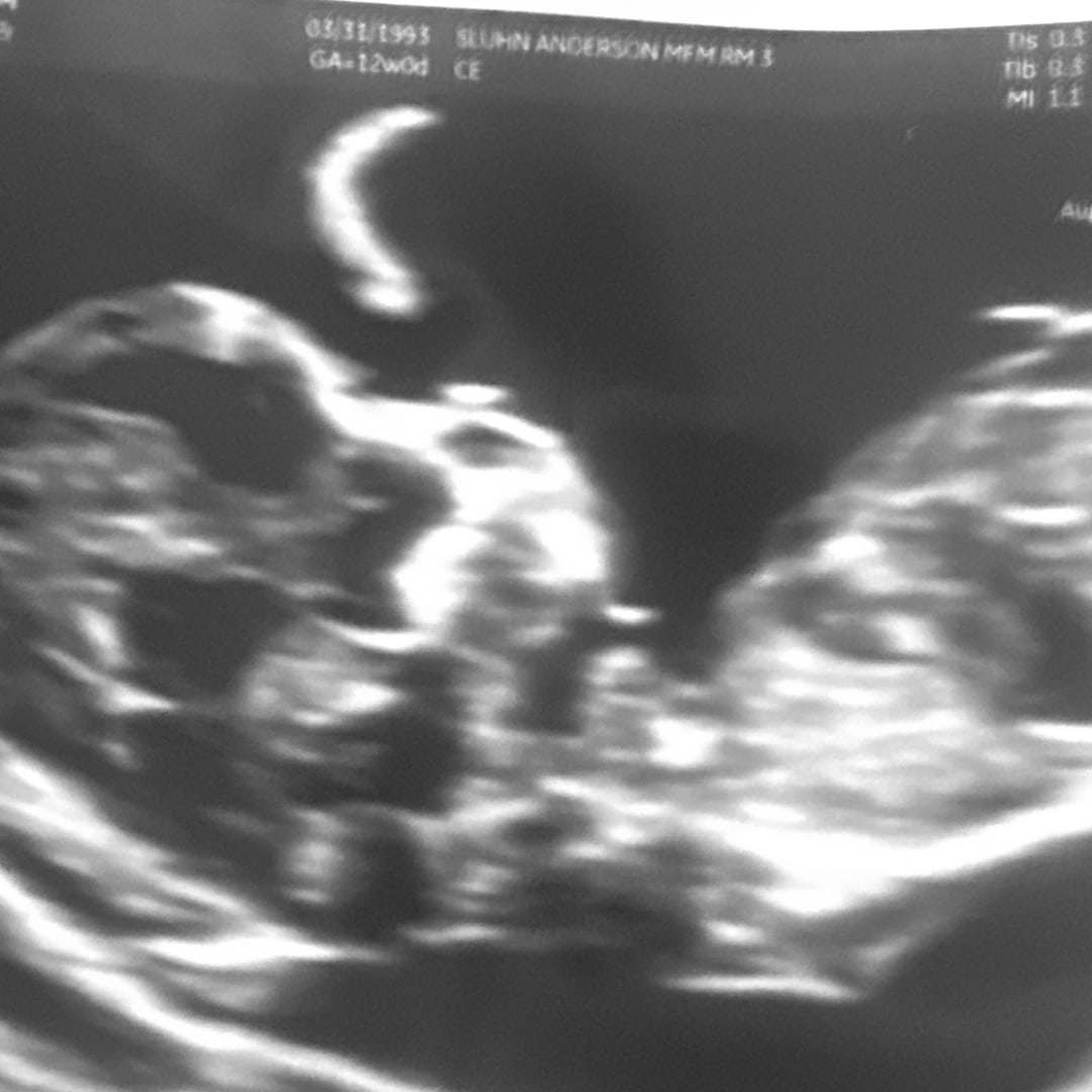 Photo shared by Erin for their Babylist baby registry.