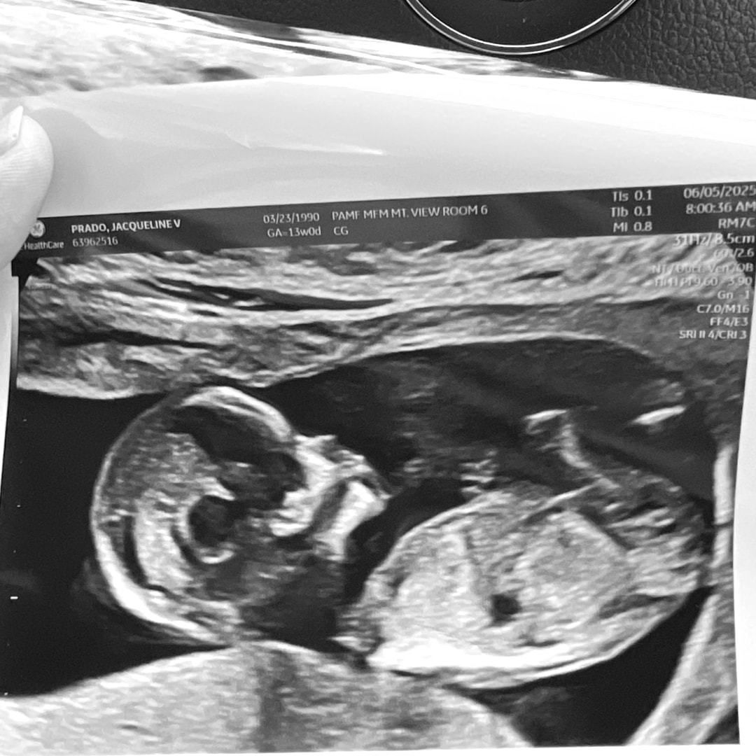 Photo shared by Jackie for their Babylist baby registry.