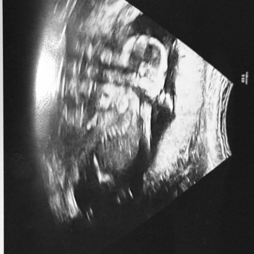 Photo shared by Emma for their Babylist baby registry.