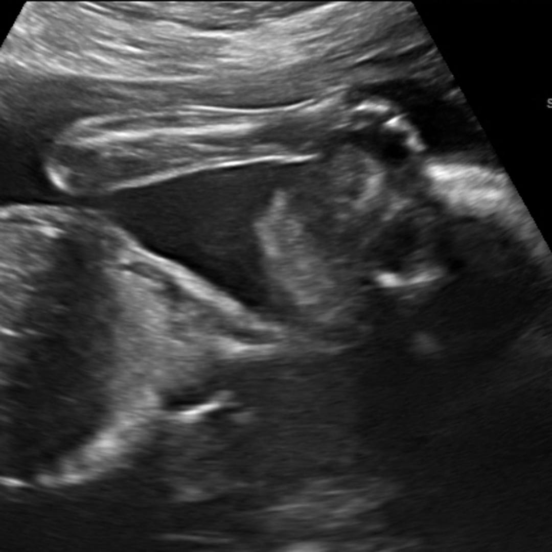 Photo shared by Shyenne for their Babylist baby registry.