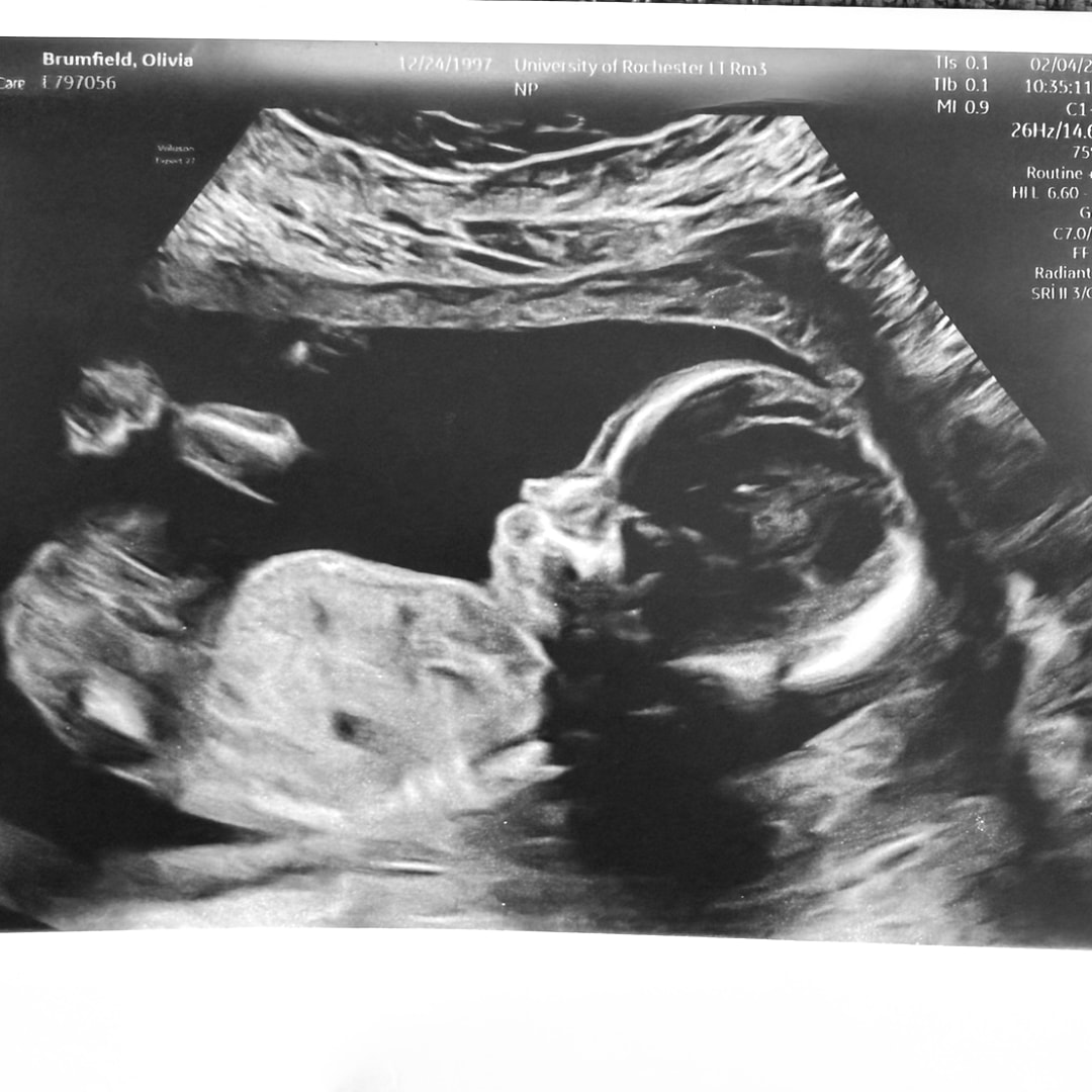 Photo shared by Olivia for their Babylist baby registry.