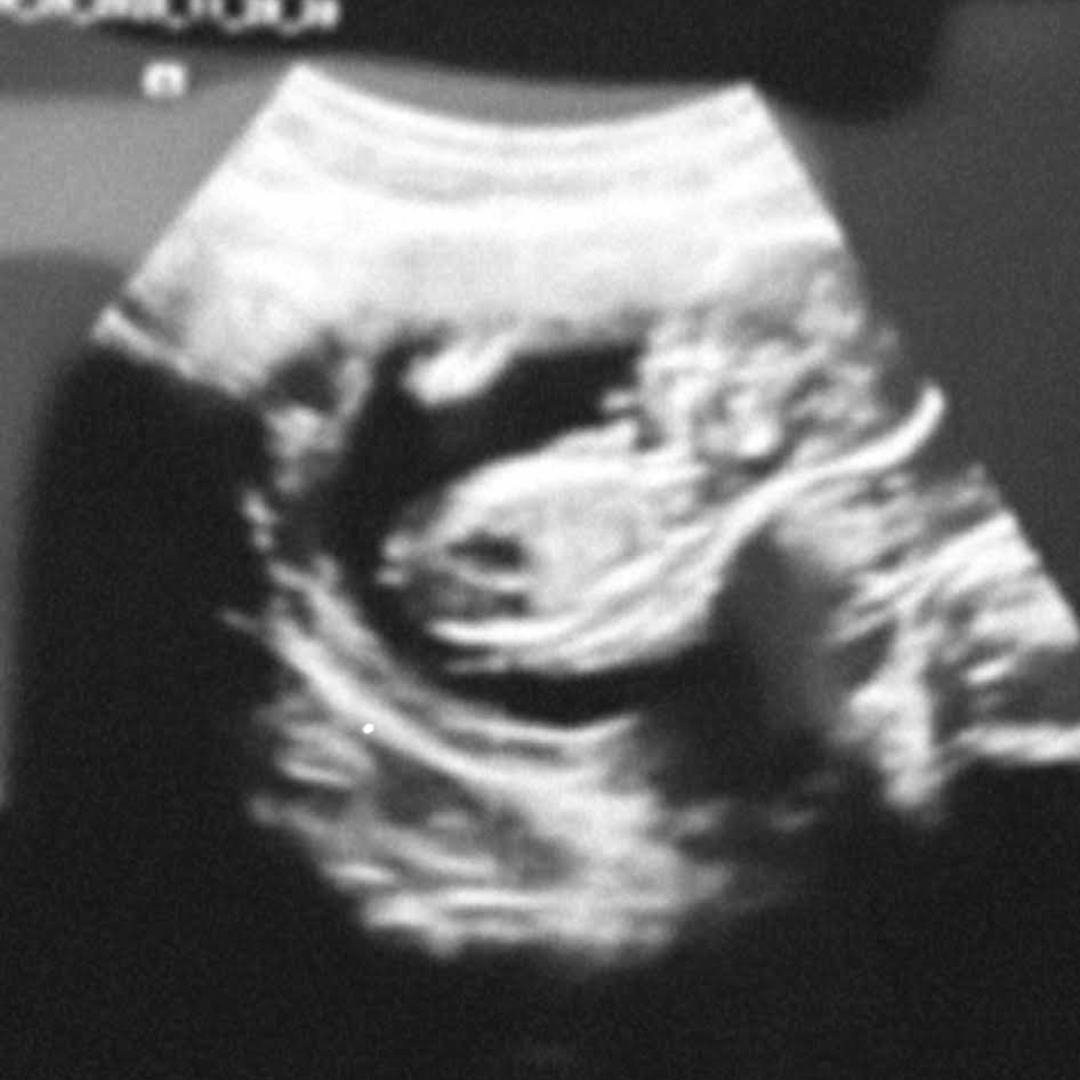 Photo shared by Jailyn for their Babylist baby registry.